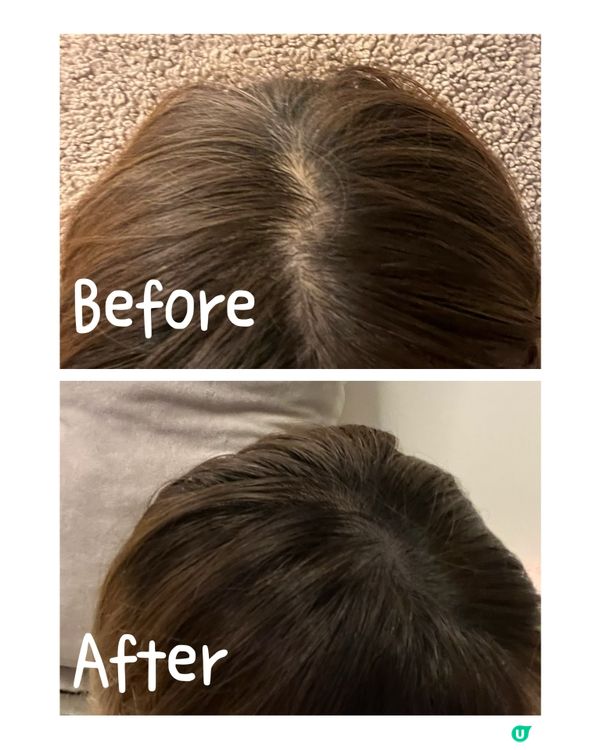 飲得嘅生髮寶物