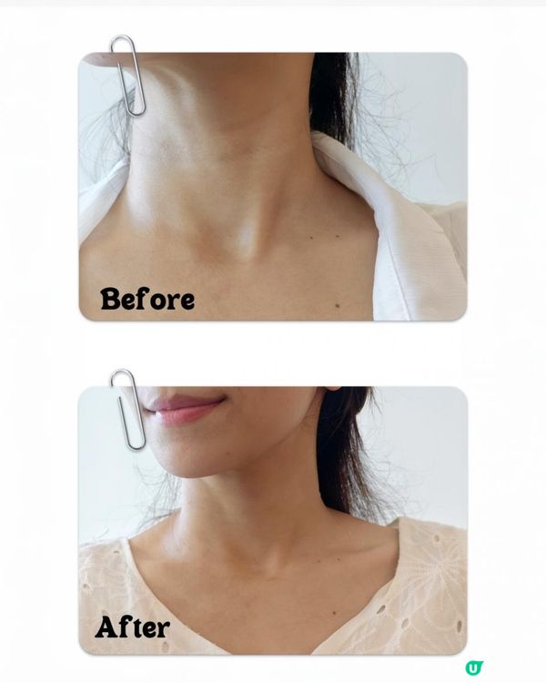 好物分享🌟currentbody 去頸紋神器