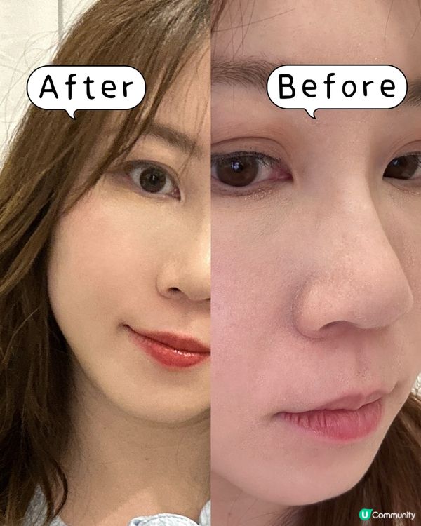 韓國急救精華！💧 100%玻尿酸勁保濕！✨