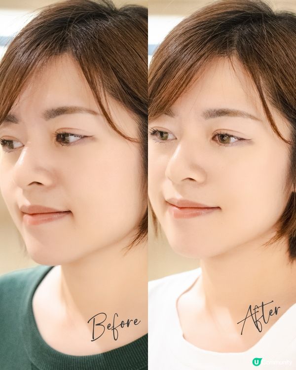 / 𝐙𝐈𝐈𝐏即時拉提｜抗衰老神器👶🏻 /