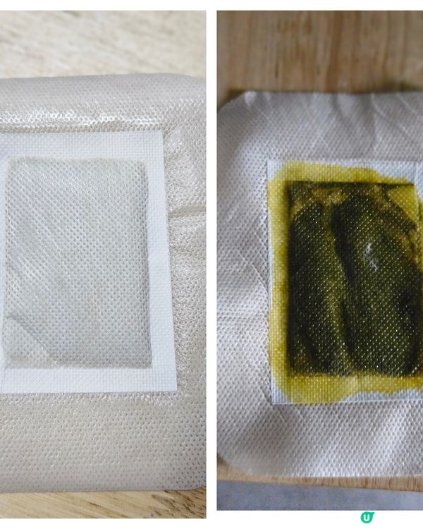 森源鱷敏油 & 足艾貼 