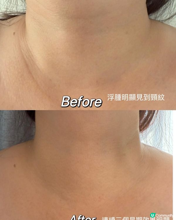 一站式全方位改善色斑、紋理、膚質