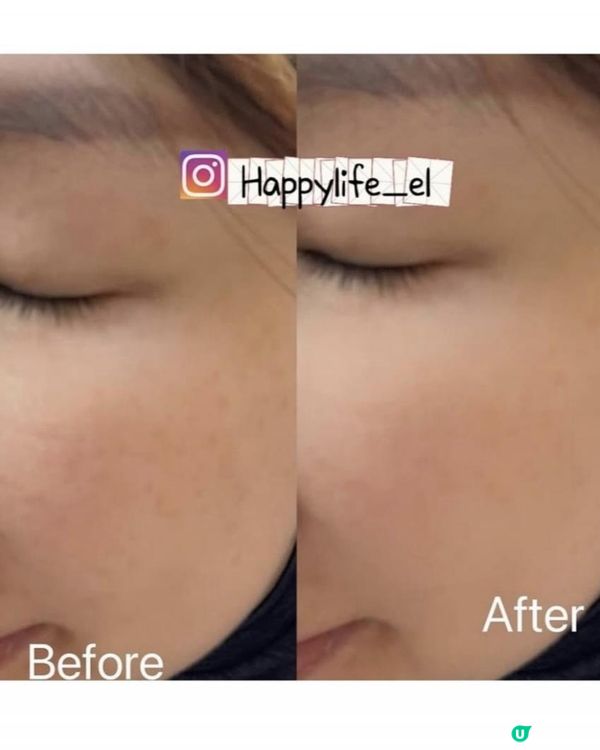 一站式全方位改善色斑、紋理、膚質