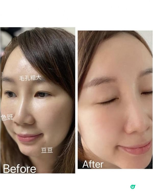 一站式全方位改善色斑、紋理、膚質