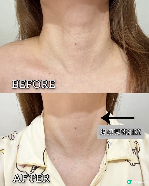 頸紋走晒！光療機救星！🤩 嫩膚神器！✨ 10分鐘搞掂