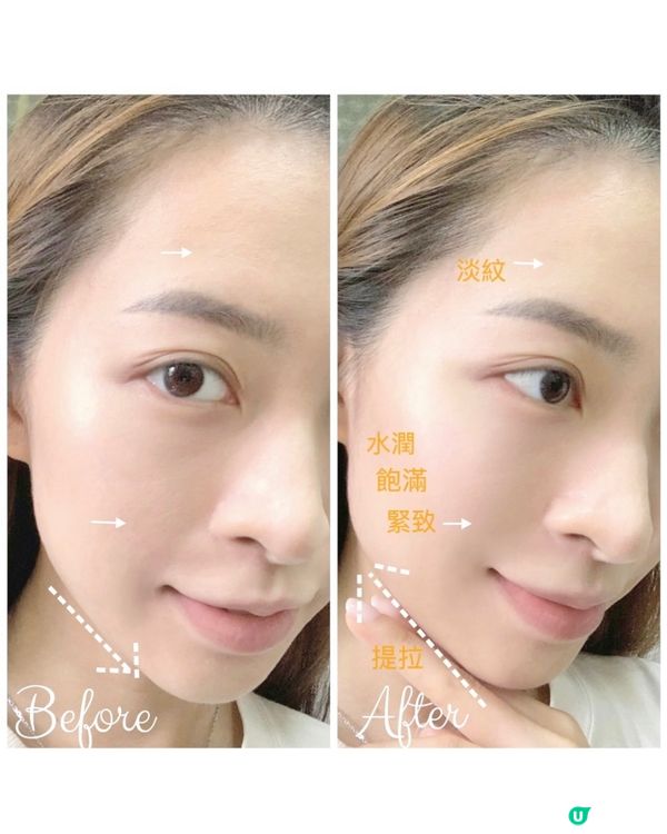 🎯抗皺提拉神器推介 ✨Project E 五合一美容儀