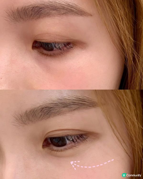 Dr. Different #極效A醛抗老淡紋眼同頸霜