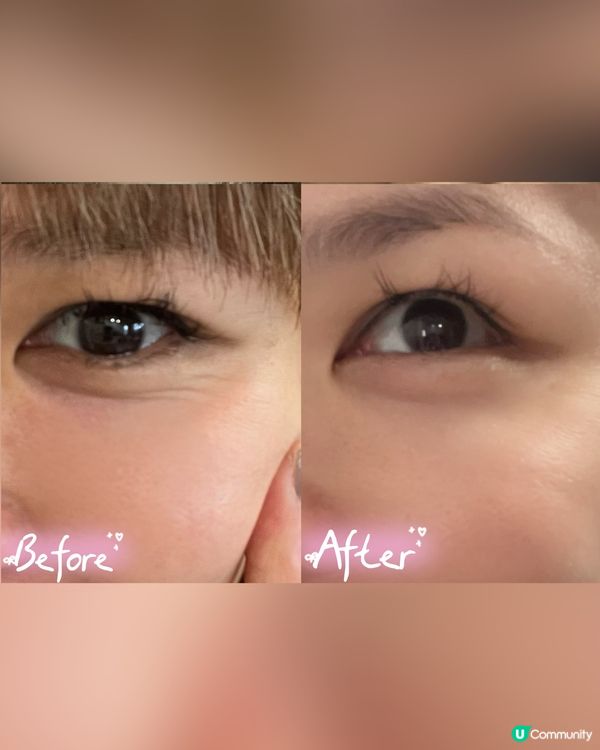 攜帶式迷你提拉儀