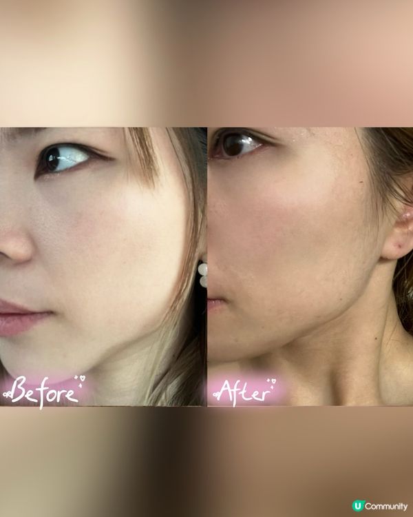 攜帶式迷你提拉儀