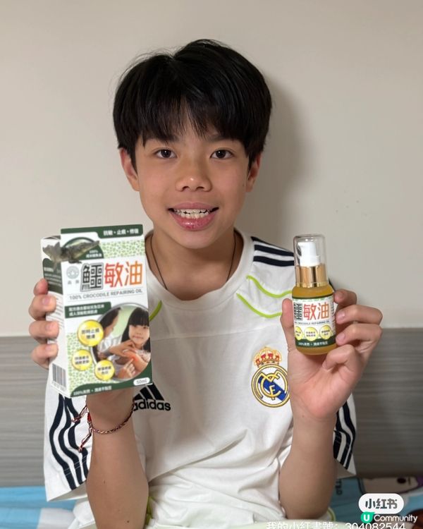 豆豆哥哥濕疹救星！森源鱷敏油+足艾貼🤩 止痕修復超快！