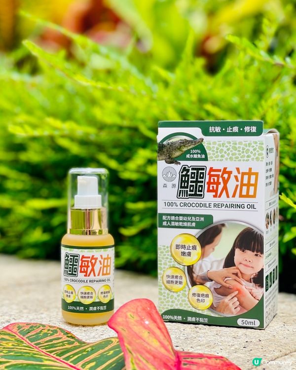 ✨濕疹救星森源鱷敏油✨