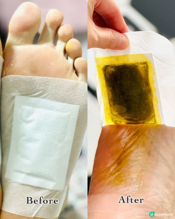 《森源安睡足艾貼》去除濕氣告別疲勞