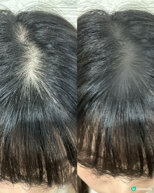 髮線危機🚨？健髮密密飲救星！💪🏻 #脫髮 #護髮 #