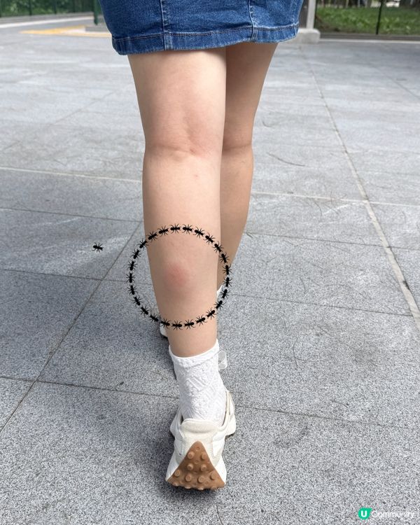 夏天蚊患真係慘！🦟 驅蚊大師幫到你！😎