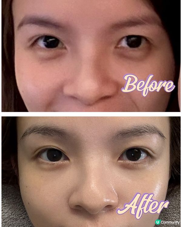 【灣仔｜Pang's Medibeauty】