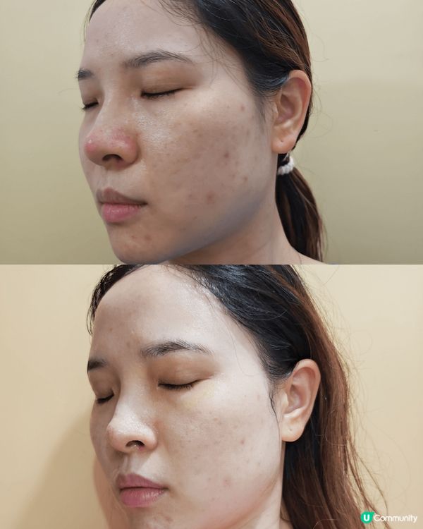 用了 Advanced water glow essence...