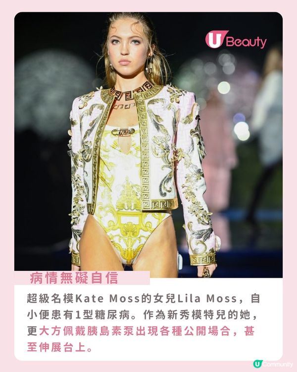 全球首款「第一型糖尿病Barbie」登場！