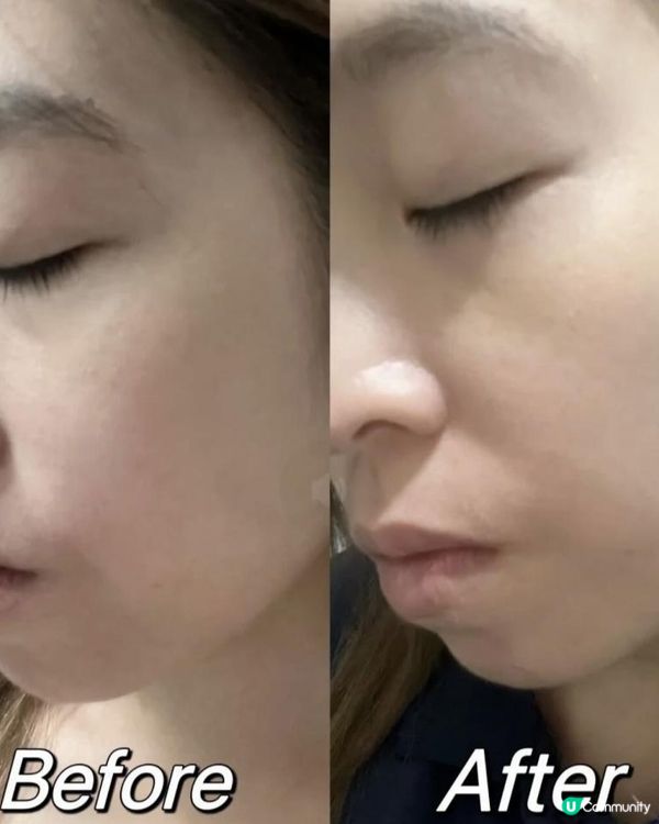 🩵INFYNYTI EGF 再生加倍修護因子精華 30ml🤍