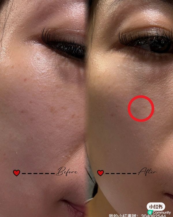 韓國護膚分享！5% OFF 優惠碼🔥✨