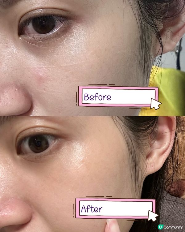 回復年輕彈性，逆齡