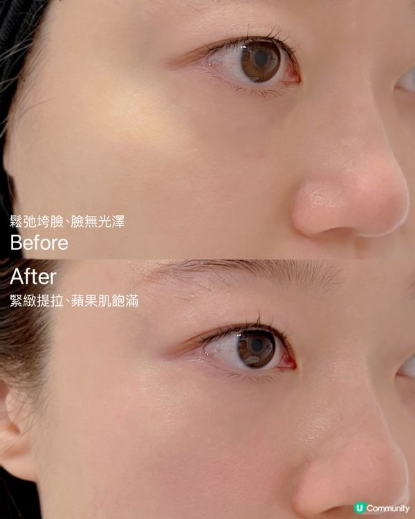 日本逆齡丸實測！瞓得好咗🤩皮膚都靚埋！