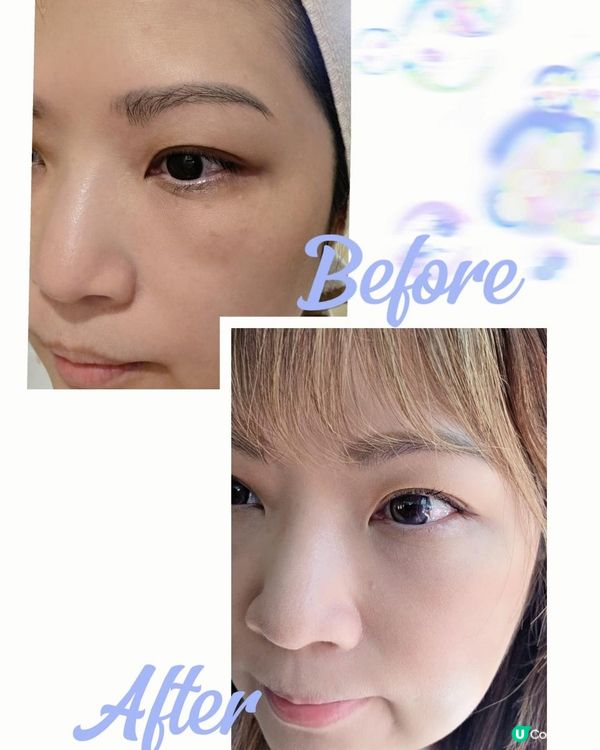 ✨【黑眼圈救星！Dr. Renew水晶針實測