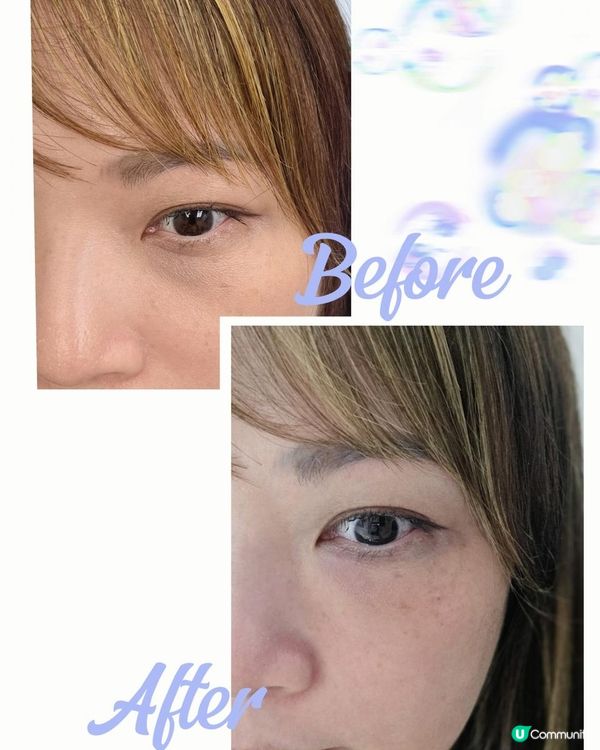 ✨【黑眼圈救星！Dr. Renew水晶針實測