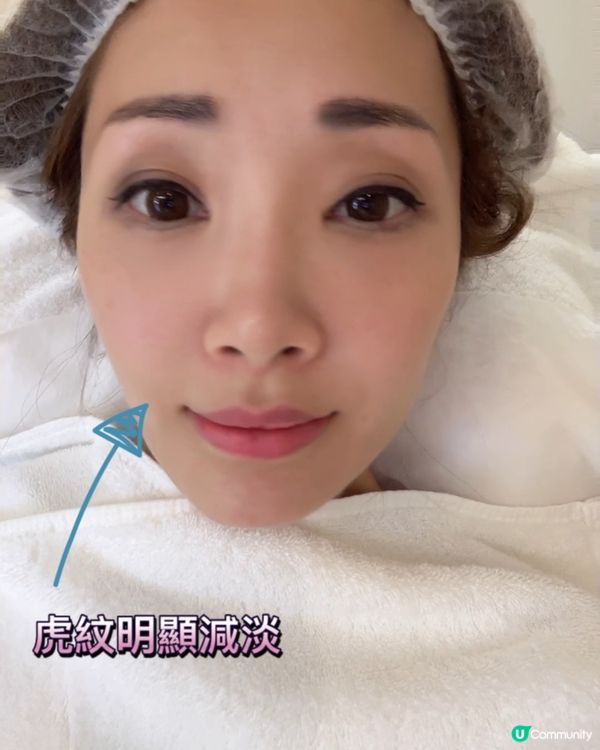 ‼️破天荒固定月費‼️ ｜ Fabula 「月式肌0 」計劃 