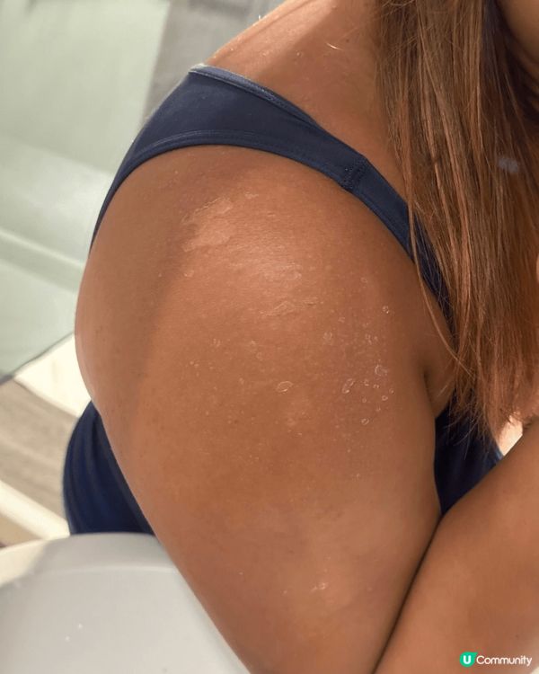 🚣水上活動狂人嘅防曬血淚史🩸