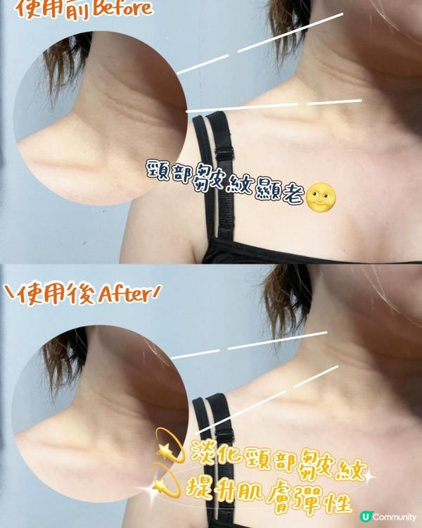 🌸 韓國女星級美肌秘訣！SL LIGHT 幫你由頸到腳靚到無死角！