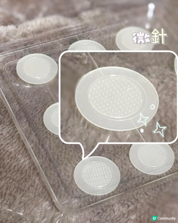 我俾自己粒大毒瘡嚇親😭又紅又腫又痛嘅石頭瘡😤