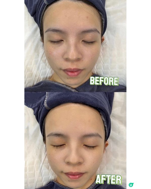 【AK USA | 童顏駐】