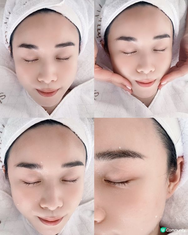 尖咀隱世美肌殿堂！無痛針清+水光針✨ 瞓著都得😴！