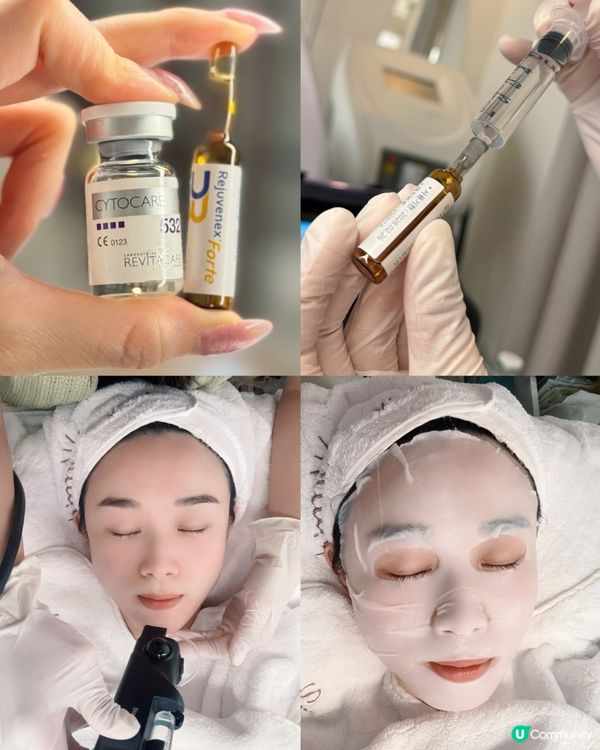 尖咀隱世美肌殿堂！無痛針清+水光針✨ 瞓著都得😴！