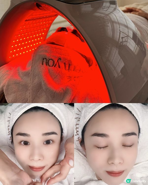 尖咀隱世美肌殿堂！無痛針清+水光針✨ 瞓著都得😴！