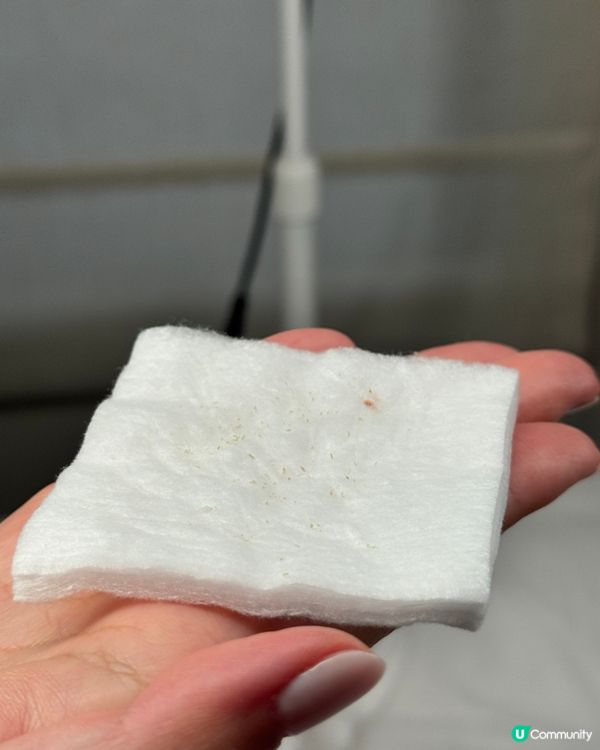 尖咀隱世美肌殿堂！無痛針清+水光針✨ 瞓著都得😴！