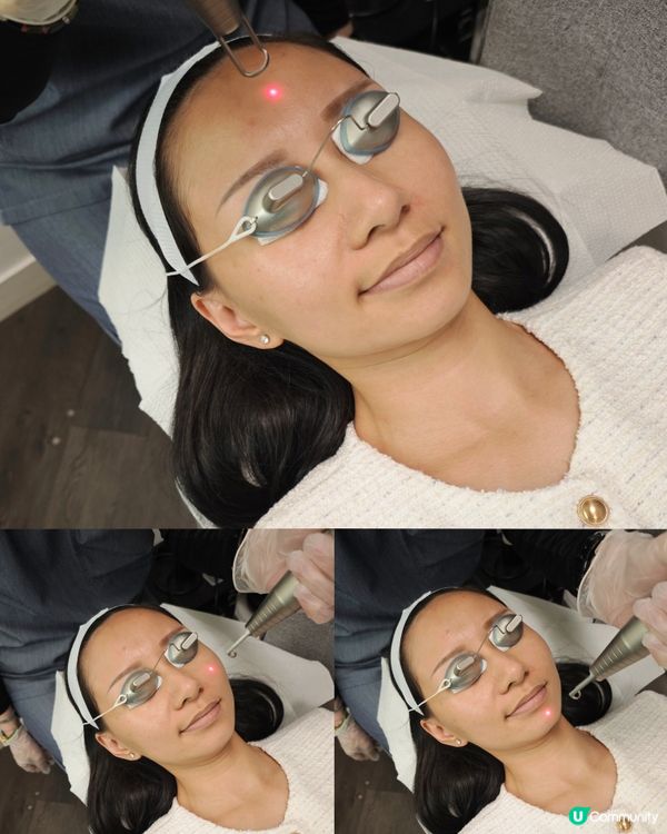 寶媽皮膚管理小妙招