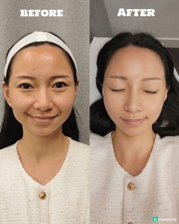 寶媽皮膚管理小妙招