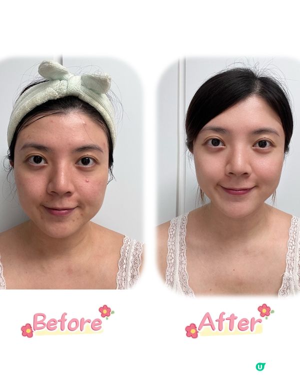 CurrentBody 6合1光療面膜儀