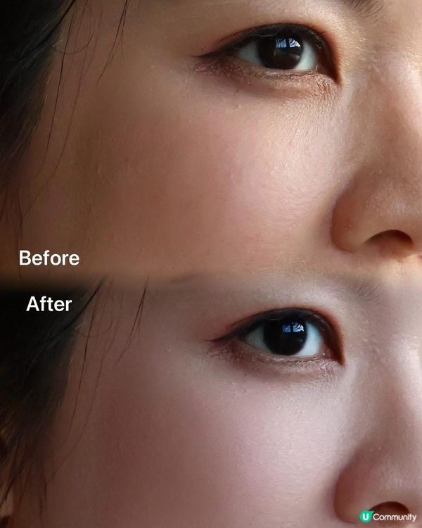 醫美後泛紅救星！✨ 兩支精華急救！💧