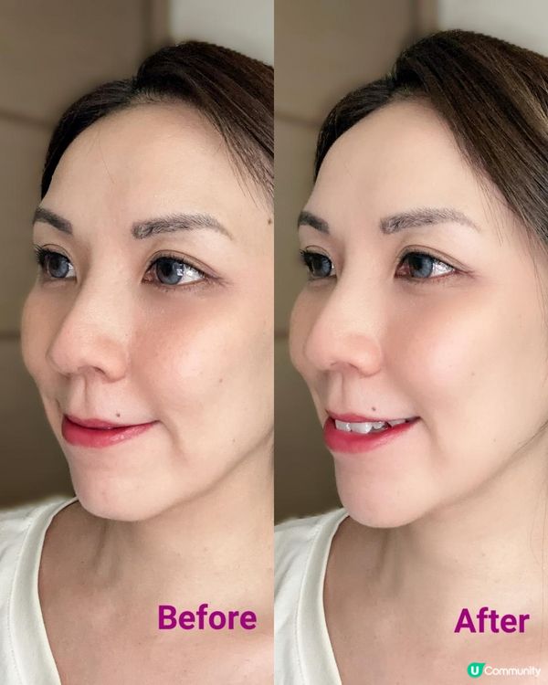 嶄新結合 ♥ 美白同時淡斑去印！►Meditherapy淨肌亮膚修護系列