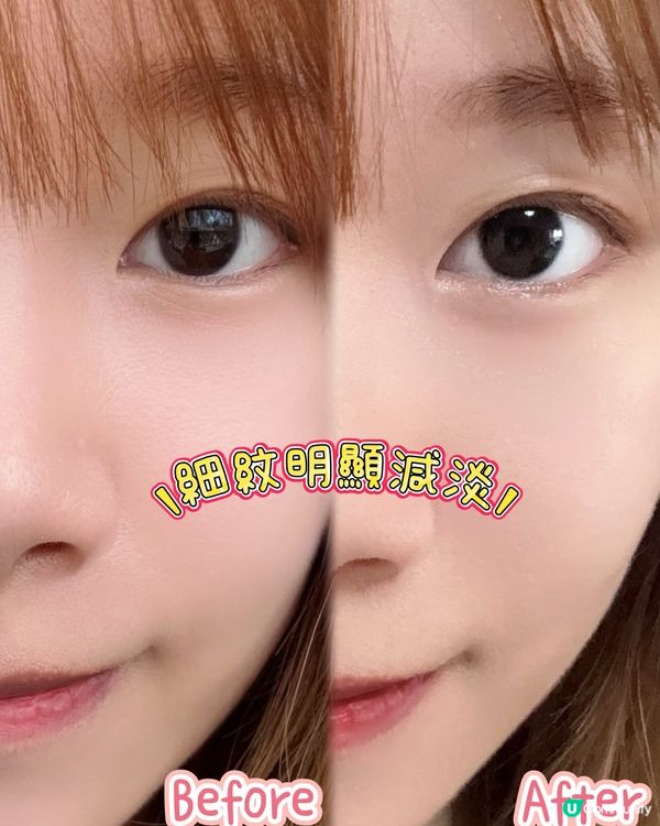 25+必睇！告別衰老肌✨平價醫美級護膚！🤩