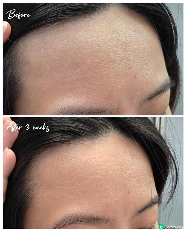 每天10分鐘改善嚴重掉髮問題