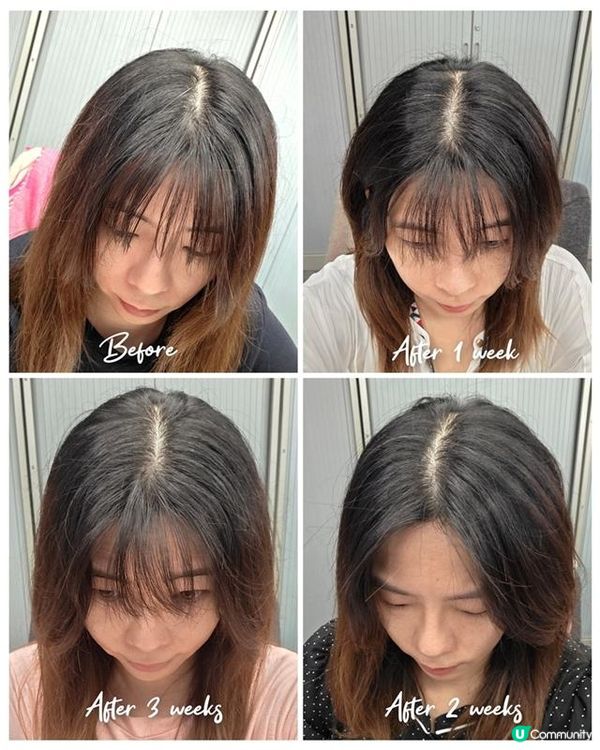 每天10分鐘改善嚴重掉髮問題