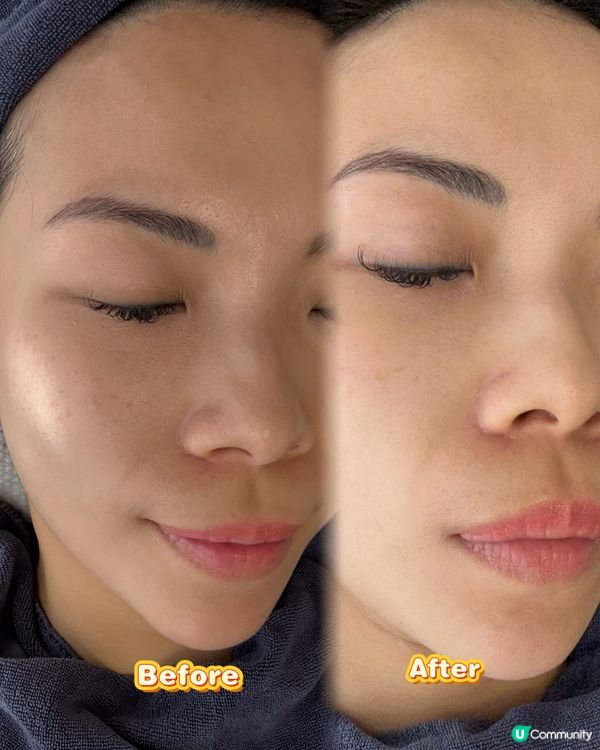 尖咀深層清潔🤩！水潤彈肌返嚟啦！✨ #美容 #護膚