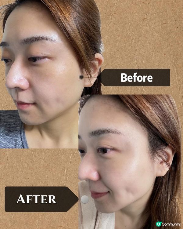 10分鐘變靚D🤩！光療面膜儀救星！搞掂晒暗瘡細紋！🔥