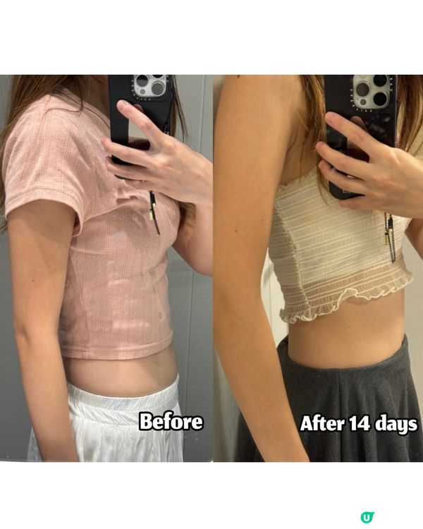 【楓之寶｜燃脂瘦身益生菌150億】