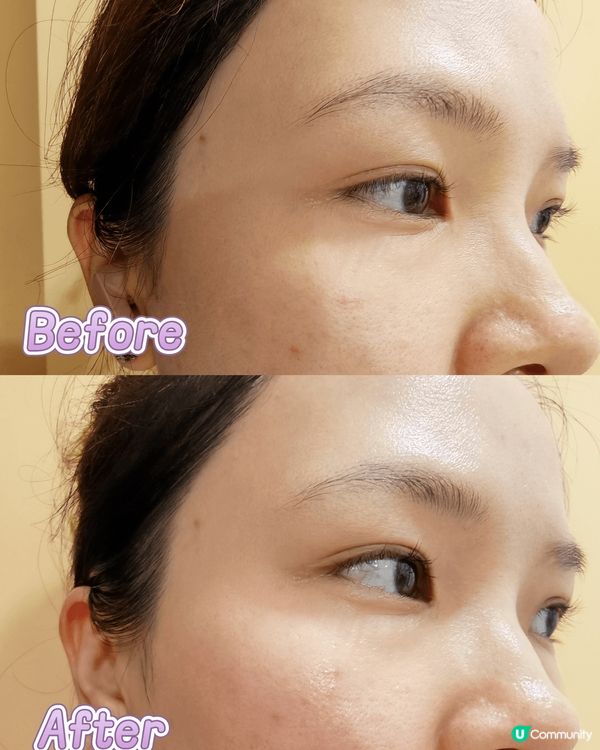 曼秀雷敦出品的眼膜真心好用，非常服貼，連續用幾日，眼下的幼紋...