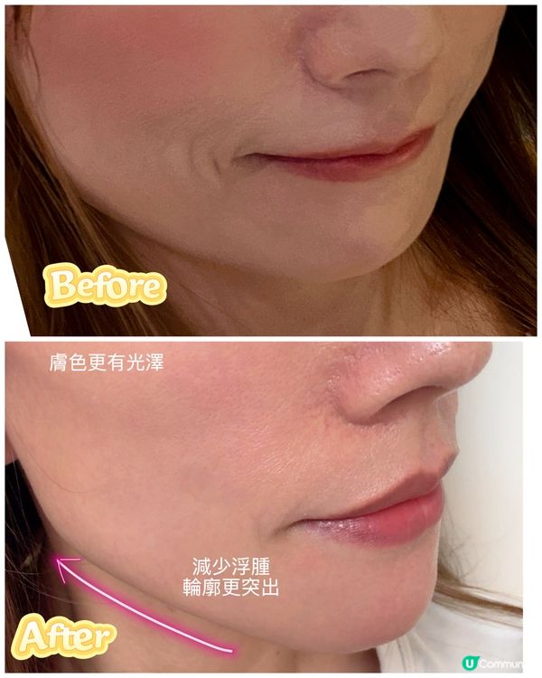 易瘦體質唔係夢！排毒孖寶幫到你🤩 同肚腩講ByeBye