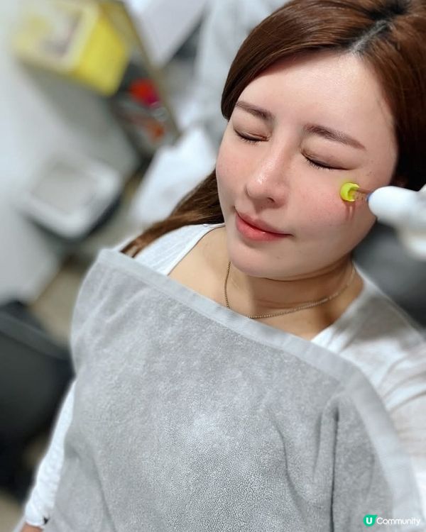 韓國最新火爆氣壓槍 ❗️即刻變靚話咁易💖